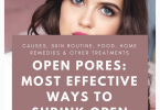 How to Get Rid of Open Pores on Face Permanently